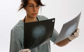 Colon-cancer-diagnosis Colon cancer diagnosis